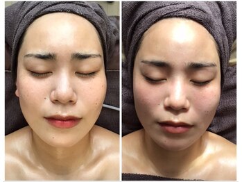 アーニャビューティー(Anya Beauty)/気持ちいいのに超絶すっきり！！