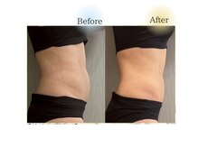 クリニカルエステ イーズ 広島祇園店/30代★ママ世代からも支持★