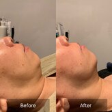 トータルエステサロン ポイント(POINT)