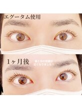 イーエヌトリップ(en.trip)/エグータム