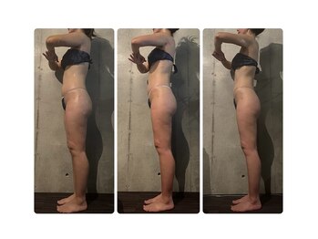 ボーレーヴ(beau reve)/痩身/インディバ/エンダモロジー