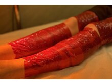 デルタエヌピー63+(δnp63+)/お客様施術例【小顔/薬院/福岡】