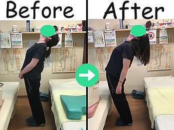杉本接骨鍼灸院/産後に腰が抜ける感じがあった