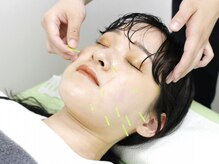 気楽鍼灸整骨院の雰囲気（《エステ限界値の小顔を造る美容鍼灸》とにかく結果にこだわる！）