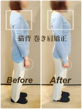 ティーエスエル とがし整体ラボ(TSL とがし整体 Labo)/小顔矯正・骨盤矯正・反り腰