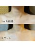 【美肌を育む】リピーター様 コラーゲンマシン60分 9,000円→8,000円