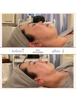 ミュー(professional beauty salon MYU)/【WIN BACK】ビフォーアフター