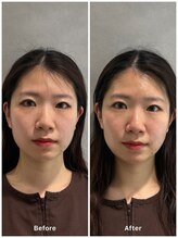 ミトノウ(MITONOU)/