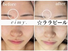 エイミー 名古屋駅前店(eimy.)/ララピール/名古屋