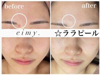 エイミー 名古屋駅前店(eimy.)/ララピール/名古屋