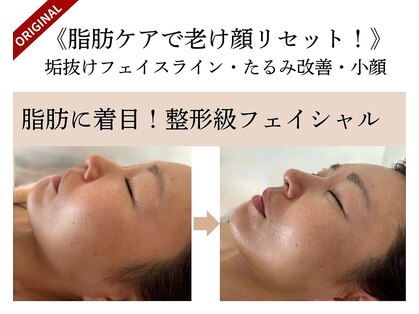 エルブラン(Herb ame)の写真