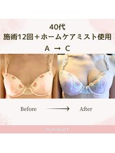 ミミバスト(mimibust)/バストアップBeforeAfter