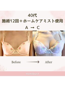 ミミバスト(mimibust)/バストアップBeforeAfter