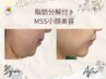 【脂肪分解付き小顔MSS美容】集中ケア　体験クーポン
