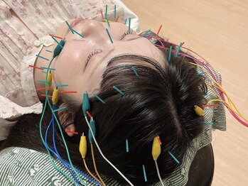 明円鍼灸治療院の写真/《鶴里駅》通常の美容鍼よりもワンランク上の電気美容鍼でお悩み改善＊若々しいお肌へと導きます◇