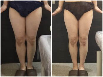 美容整体ウェリナ 名駅院/小顔矯正/骨盤矯正/美脚サロン