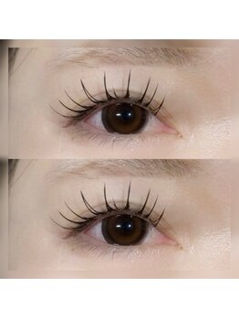 フロラ(Flora)/◇バインドロック