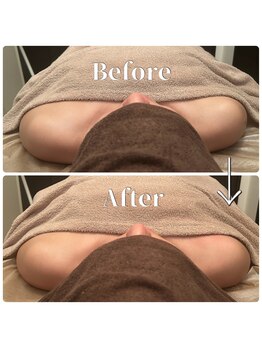 フィール(feel)/整体+リンパ Before & After