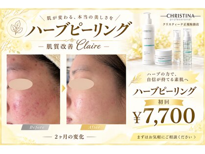 クレア(Claire)の写真