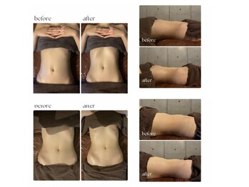 ボーレーヴ(beau reve)/痩身/インディバ/エンダモロジー