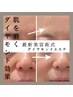 【人気NO１ほうれい線たるみ毛穴】ダイヤモンドエステ60分26000円→20000円