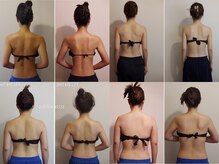 肩甲骨出し、肩の張り◎華奢ボディなら｢筋膜リリース｣×｢腸もみ｣