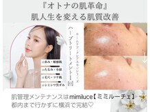 ミミルーチェ(mimiluce)