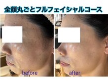 ビオール 池袋店(beall)の雰囲気(フェイシャルも大人気★どんなお悩みも解決に導きます★)