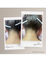 ブラジリアンワキシング シックスナイン(BrazilianWaxing69)/女性 / うなじ