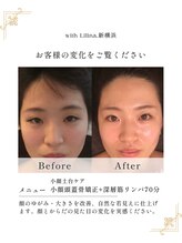 ウィズリリナ 新横浜(with Lilina.)/お顔の第一印象UPで自信もアップ