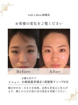 ウィズリリナ 新横浜(with Lilina.)/お顔の第一印象UPで自信もアップ