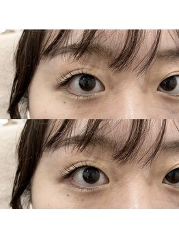 シーディーエム(cdm)/ラッシュカール