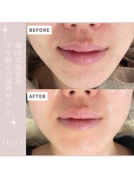 イチ(ichi)/水光肌フェイスワックス