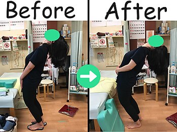 杉本接骨鍼灸院/出産後1年経過した頃に腰痛