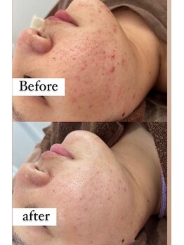 ルヴィ 浦添店(REVI)/