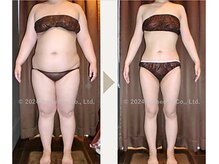 圧倒的にきれいに痩せる！