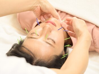 ハリ ヴァカンス(Hari Vacances)の写真/フェイスライン、ほうれい線「感動レベルの美容鍼」Hari Vacances美容鍼のアプローチを体感出来るチャンス!