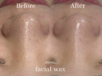 ファミーユ 太田(Fameu)/facial wax
