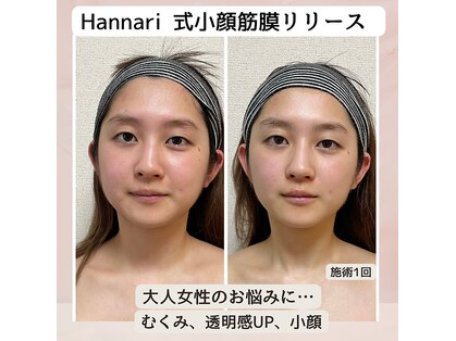 ハンナリ(Hannari)の写真