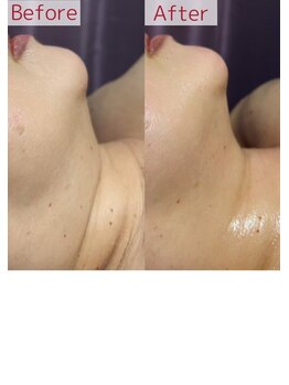 サロンドカモン(salon de 華門)/新技術プラズマシャワー効果!