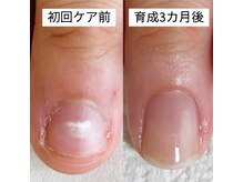 シーネイル(C Nail)の雰囲気（ネイルケアで自爪育成3ヶ月コース縦長美爪になりたい方にお勧め）