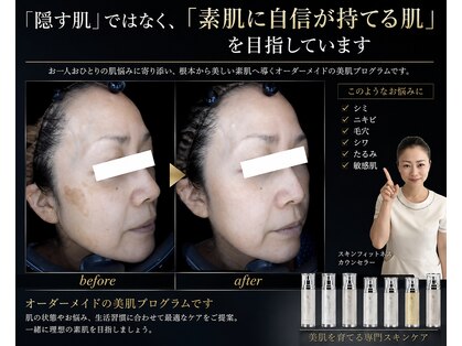 アトレの写真