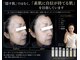 アトレの写真