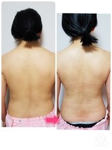 キレイとケンコウの応援サロン杉山/お背中の筋膜リリース30分