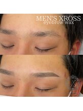 クロス(XROSS)/メンズ眉毛ワックス脱毛