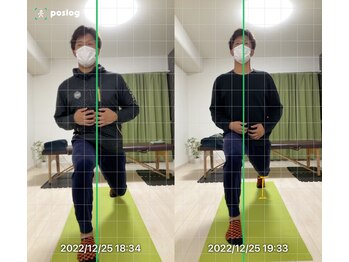 エヴォストレッチ(EVO STRETCH)/20代男性【股関節の詰まり感】