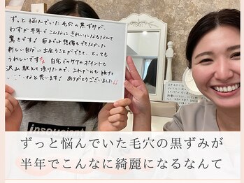 メモリ/毛穴ケア専用ビタミンCの導入