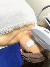 ハーニーズ(HARNEYS)/【美肌顔脱毛】照射