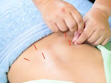 キュアハンズ 大森/マッサージと鍼を同時に