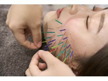 ヴィーライン 大阪梅田院(VeLine)/形状記憶美容鍼